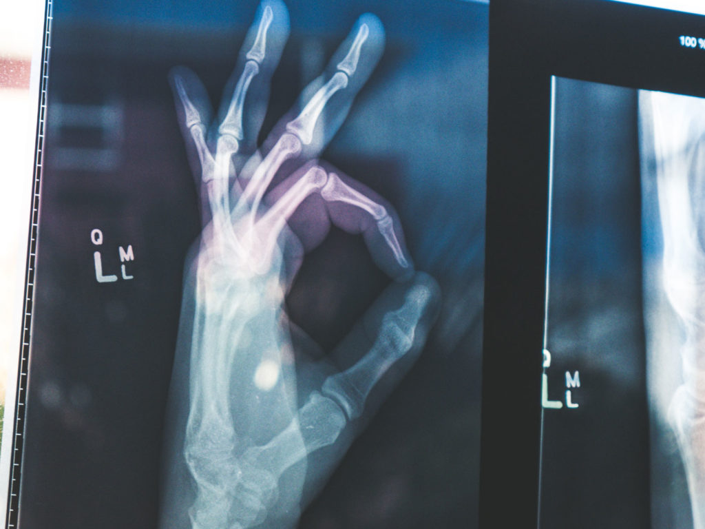 X-ray of hand